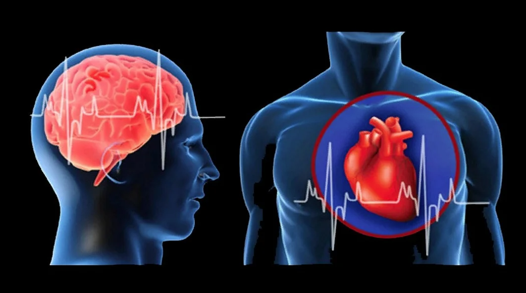 Чем отличается инфаркт от инсульта простыми